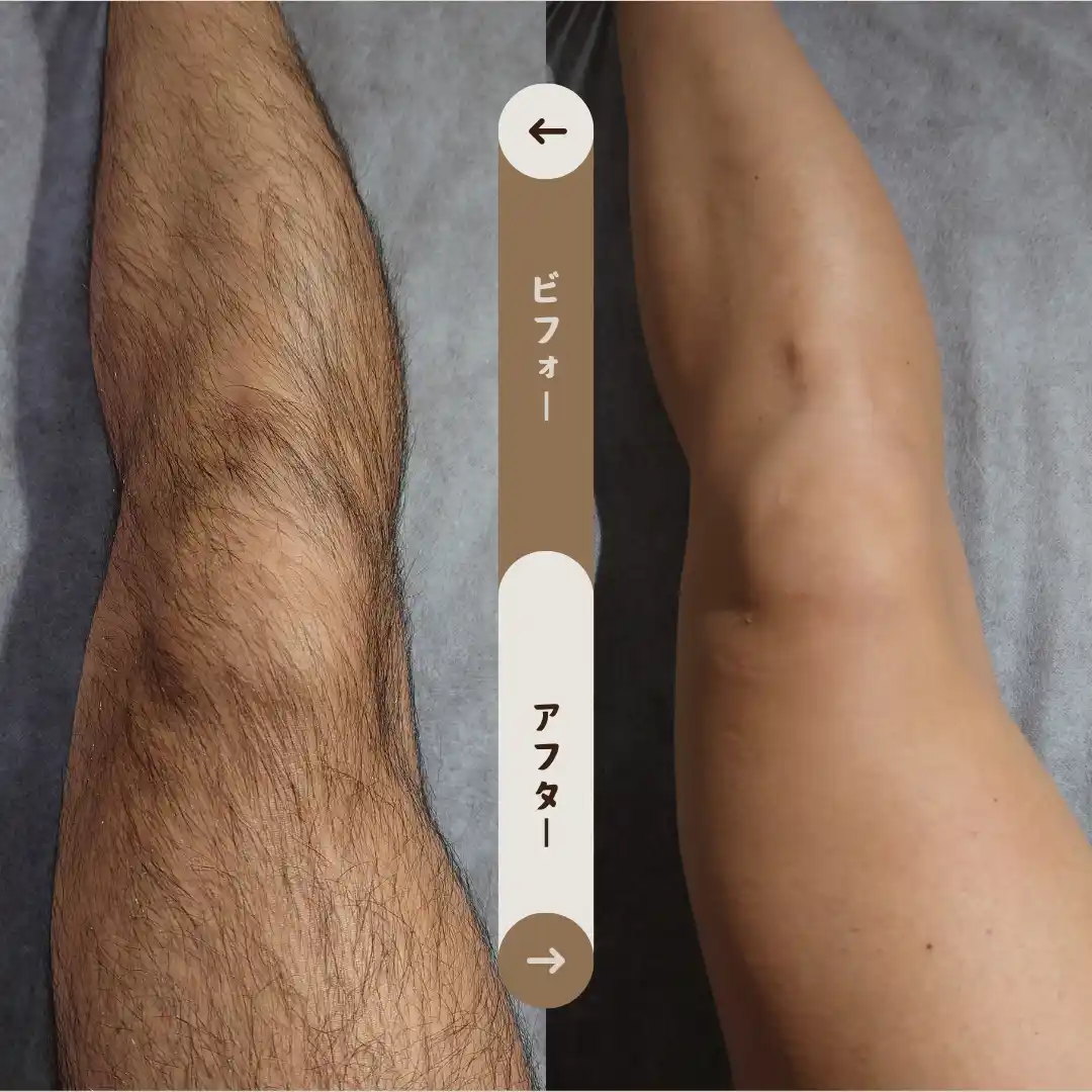 足全体 Before&After