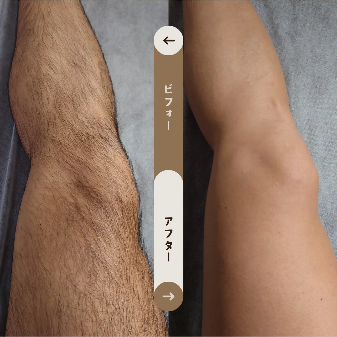 足全体 Before&After