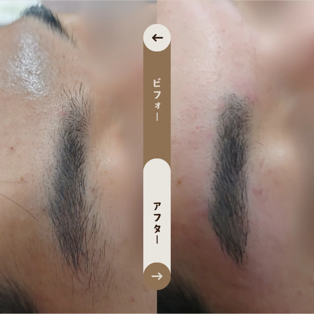 アイブロウ Before&After
