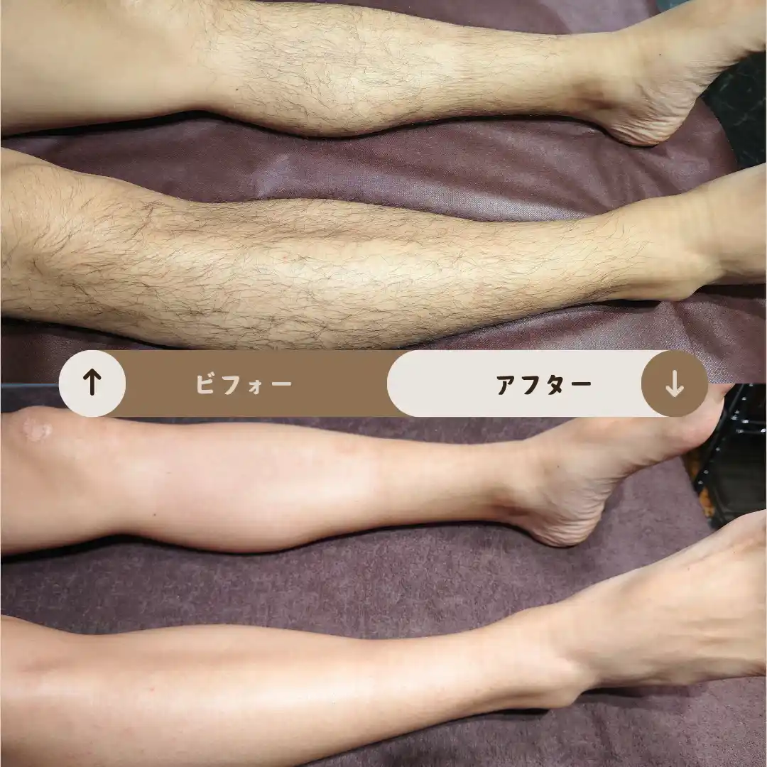 足全体 Before&After