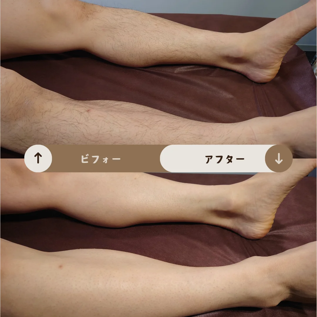 足全体 Before&After